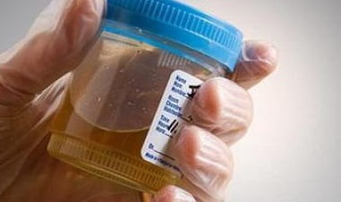 Олигурия причины