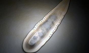 Описторхоз причины