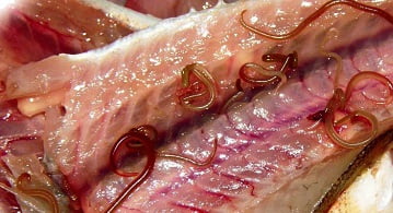 Описторхоз симптомы