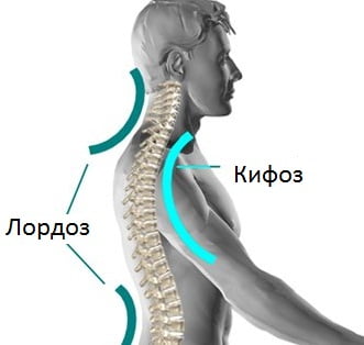 Шейный лордоз причины