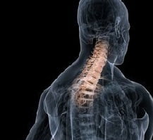 Шейный лордоз